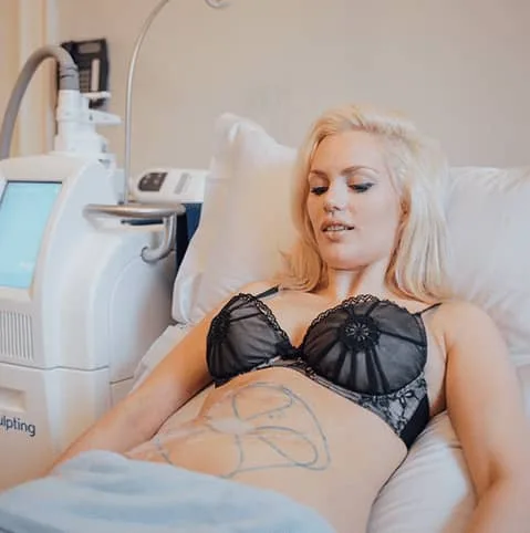 Woman on a treatment couch with treatment areas marked on her abdomen at Cool Clinic, CoolSculpting fat freezing Amsterdam