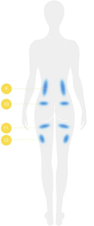 CoolSculpting fat freezing Amsterdam - back body diagram with numbered treatable fat areas Back body diagram with numbered treatable fat areas for CoolSculpting fat freezing in Amsterdam