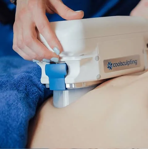 Hands fitting a fat freezing applicator to a patient's abdomen at Cool Clinic, CoolSculpting fat freezing Amsterdam